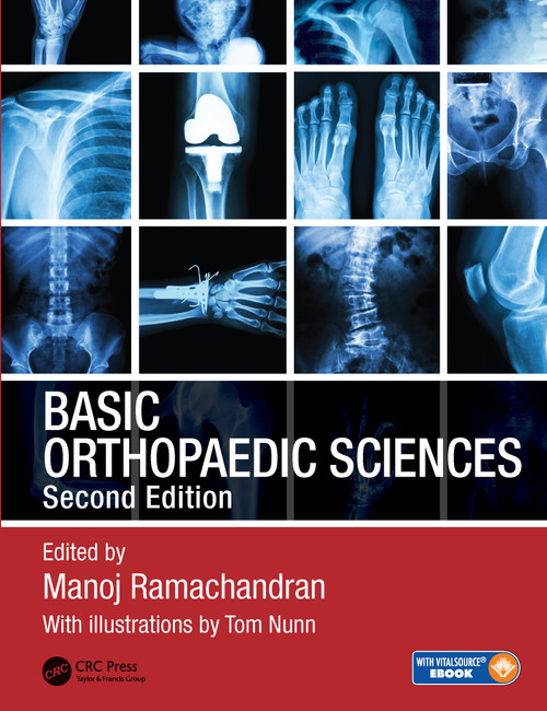 Basic Orthopaedic Sciences by Manoj Ramachandran, 9781444120981