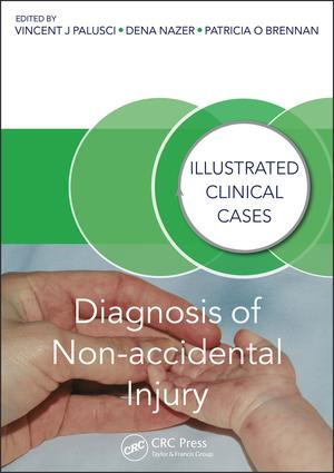 Diagnosis of Non-accidental Injury (Illustrated Clinical Cases) by Vincent J. Palusci, Dena Nazer, Patricia Brennan, 9781482230130