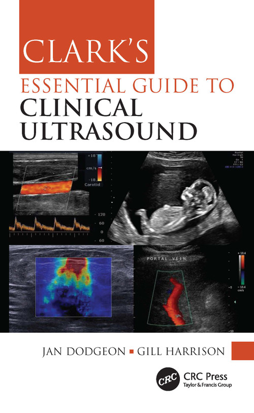 Clark's Essential Guide to Clinical Ultrasound by Jan Dodgeon, Gill Harrison, 9780367771164