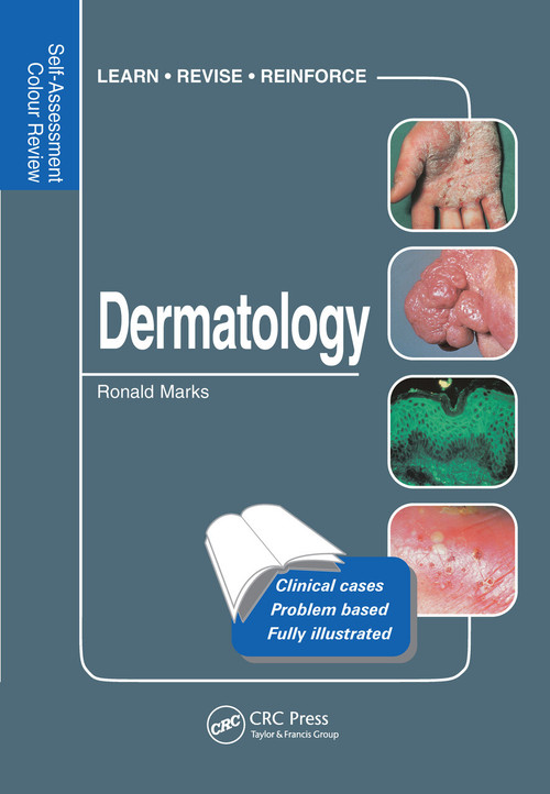 Dermatology (Self-Assessment Colour Review) by Ronald Marks, 9781840761665