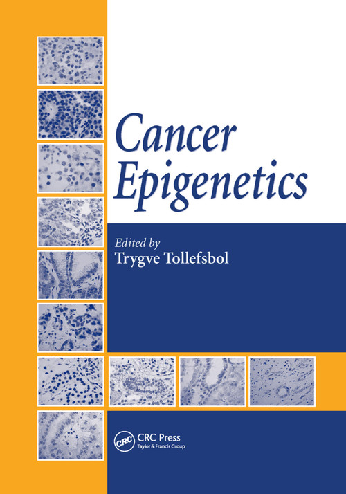Cancer Epigenetics by Trygve Tollefsbol, 9780367386863