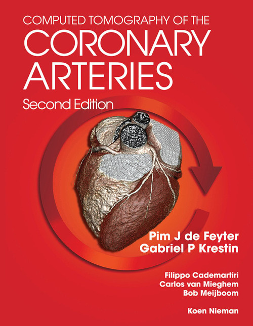 Computed Tomography of the Coronary Arteries by Pim J. de Feyter, G. P. Gabriel Krestin, 9780367452568