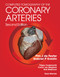 Computed Tomography of the Coronary Arteries by Pim J. de Feyter, G. P. Gabriel Krestin, 9780367452568