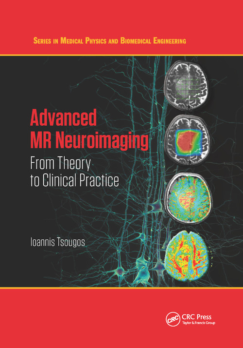 Advanced MR Neuroimaging (From Theory to Clinical Practice) by Ioannis Tsougos, 9780367876500