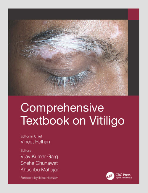 Comprehensive Textbook on Vitiligo by Vineet Relhan, Vijay Kumar Garg, Sneha Ghunawat, Khushbu Mahajan, 9780367543723