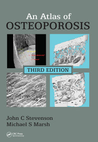 An Atlas of Osteoporosis - 9780367452810 by John C. Stevenson, Michael S. Marsh, 9780367452810