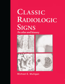 Classic Radiologic Signs (An Atlas and History) by M.E. Mulligan, 9780367401153
