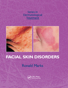 Facial Skin Disorders by Ronald Marks, 9780367389390