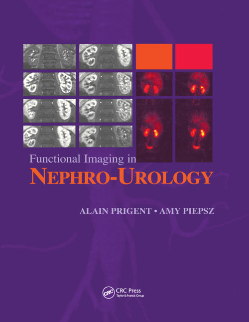 Functional Imaging in Nephro-Urology by Alain Prigent, Amy Piepsz, 9780367391270