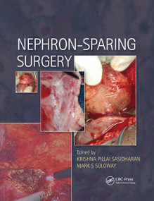 Nephron-Sparing Surgery by Krishna Sasidharan, Mark Soloway, 9780367446185