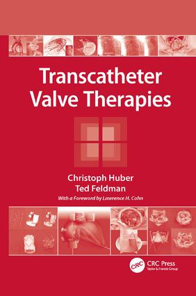 Transcatheter Valve Therapies by Christoph Huber, Ted Feldman, 9781138116108