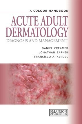 Acute Adult Dermatology (Diagnosis and Management: A Colour Handbook) by Daniel Creamer, Jonathan Barker, Francisco A. Kerdel, 9781840761023