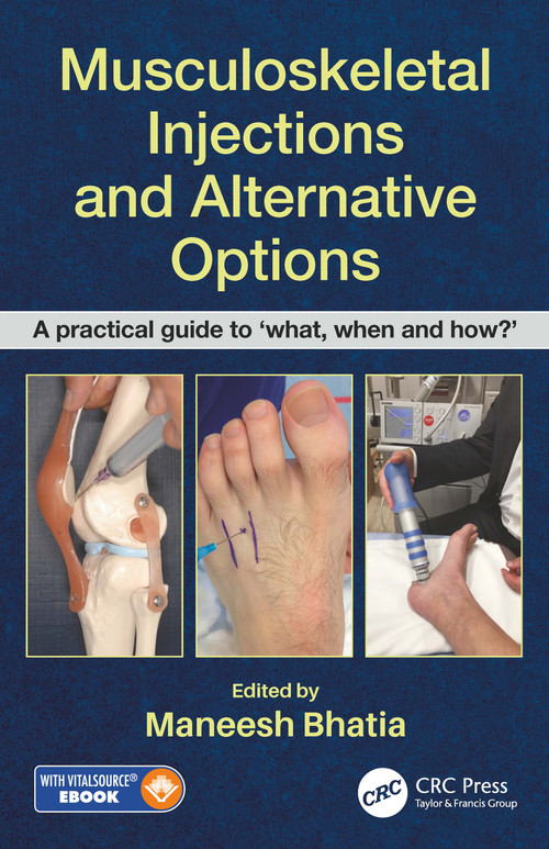 Musculoskeletal Injections and Alternative Options (A practical guide to 'what, when and how?') by Maneesh Bhatia, 9780815355540