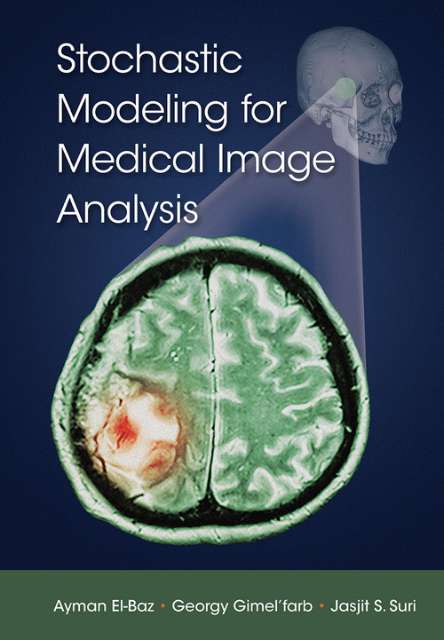 Stochastic Modeling for Medical Image Analysis by Ayman El-Baz, Georgy Gimel'farb, Jasjit S. Suri, 9781032237541