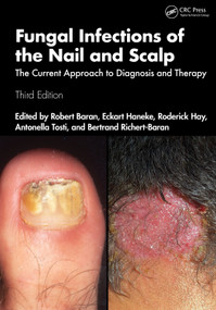 Fungal Infections of the Nail and Scalp (The Current Approach to Diagnosis and Therapy) by Robert Baran, Eckart Haneke, Roderick Hay, Antonella Tosti, Bertrand Richert-Baran, 9781032464305