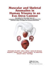 Muscular and Skeletal Anomalies in Human Trisomy in an Evo-Devo Context by Rui Diogo, Christopher M. Smith, Janine M. Ziermann, Julia Molnar, Marjorie C. Gondre-Lewis, Corinne Sandone, Edward T. Bersu, Mohammed Ashraf Aziz, 9780367377793