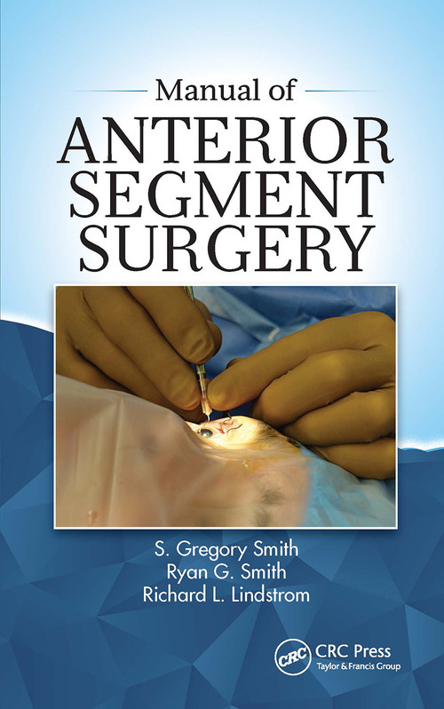 Manual of Anterior Segment Surgery by S Gregory Smith, Ryan Smith, Richard Lindstrom, 9781630916206