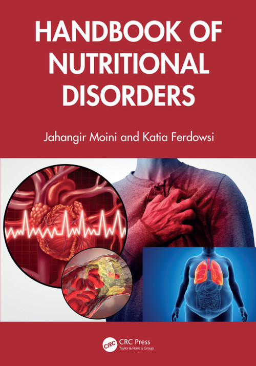 Handbook of Nutritional Disorders by Jahangir Moini, Katia Ferdowsi, 9781032591810