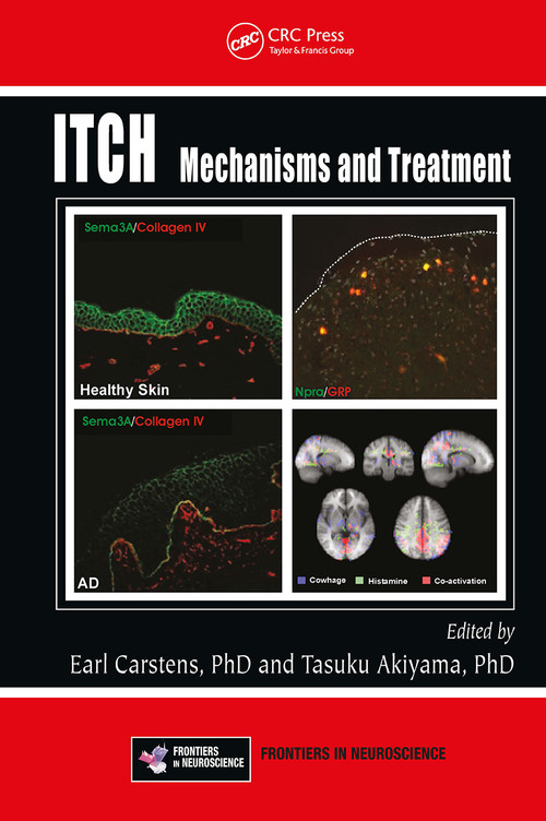 Itch (Mechanisms and Treatment) by E. Carstens, Tasuku Akiyama, 9781032919317