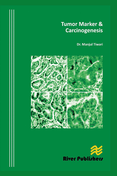 Tumor Marker and Carcinogenesis - 9788770045223 by Manjul Tiwari, 9788770045223