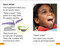 DK Super Readers Level 1 A Trip to the Dentist by DK, 9780593962442