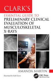 Clark's Essential Guide to Preliminary Clinical Evaluation of Musculoskeletal X-rays by Amanda Martin, Ruth Eaves, 9781032832920