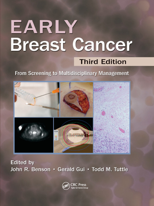 Early Breast Cancer (From Screening to Multidisciplinary Management, Third Edition) by John R Benson, Gerald P.H. Gui, Todd Tuttle, 9780367380465