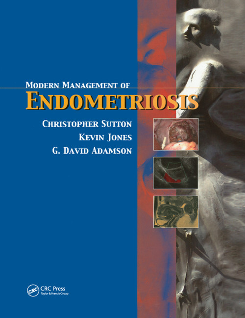 Modern Management of Endometriosis by Christopher Sutton, G. David Adamson, Kevin D. Jones, 9780367391669