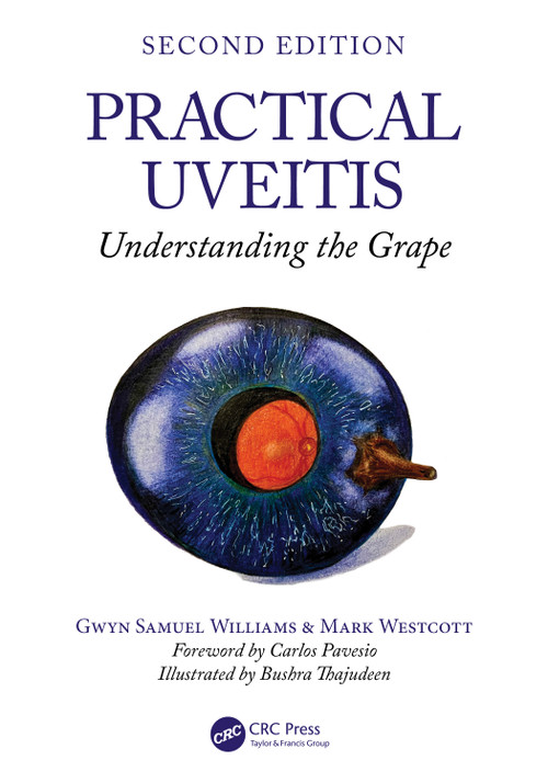 Practical Uveitis (Understanding the Grape) - 9781032757230 by Gwyn Samuel Williams, Mark Westcott, 9781032757230