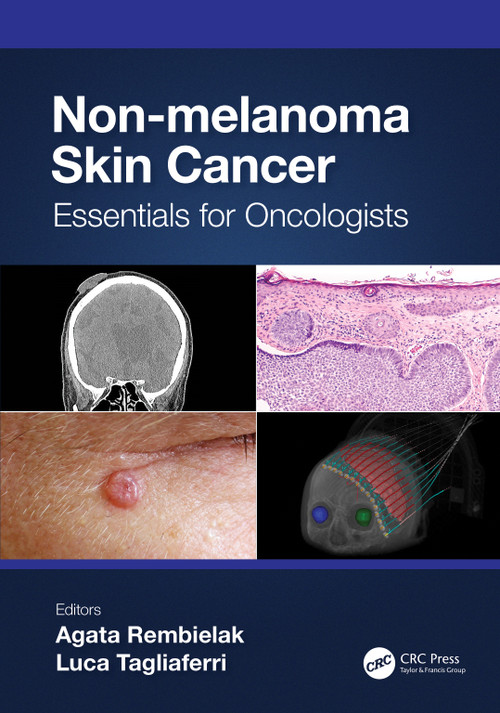 Non-melanoma Skin Cancer (Essentials for Oncologists) by Agata Rembielak, Luca Tagliaferri, 9781032127415