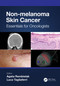 Non-melanoma Skin Cancer (Essentials for Oncologists) by Agata Rembielak, Luca Tagliaferri, 9781032127415