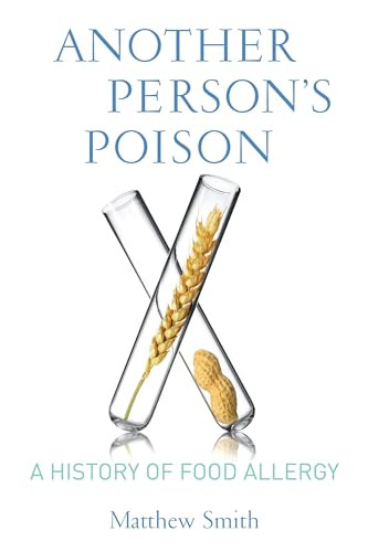 Another Person's Poison (A History of Food Allergy) by Matthew Smith, 9780231164856