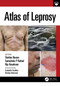 Atlas of Leprosy by Shekhar Neema, Santoshdev Rathod, Biju Vasudevan, 9781032209234
