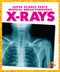 X-Rays - 9781645278047 by Alicia Z. Klepeis, 9781645278047