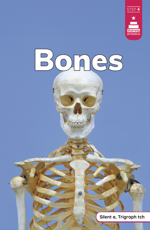 Bones - 9798875227134 by Laura Stickney, 9798875227134