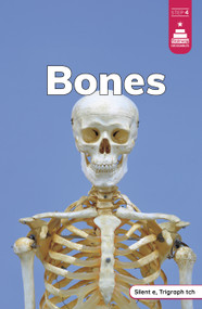 Bones - 9798875227134 by Laura Stickney, 9798875227134
