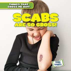 Scabs Are So Gross! by Lynda Arnez, 9781482471441