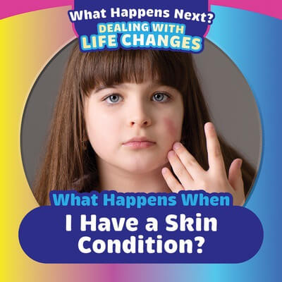 What Happens When I Have a Skin Condition? by Emiliya King, 9781499452631
