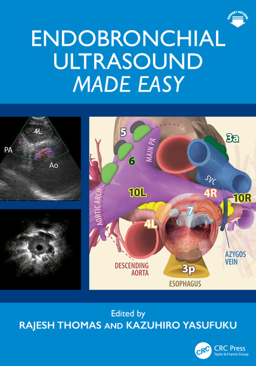 Endobronchial Ultrasound Made Easy by Rajesh Thomas, Kazuhiro Yasufuku, 9780367630751