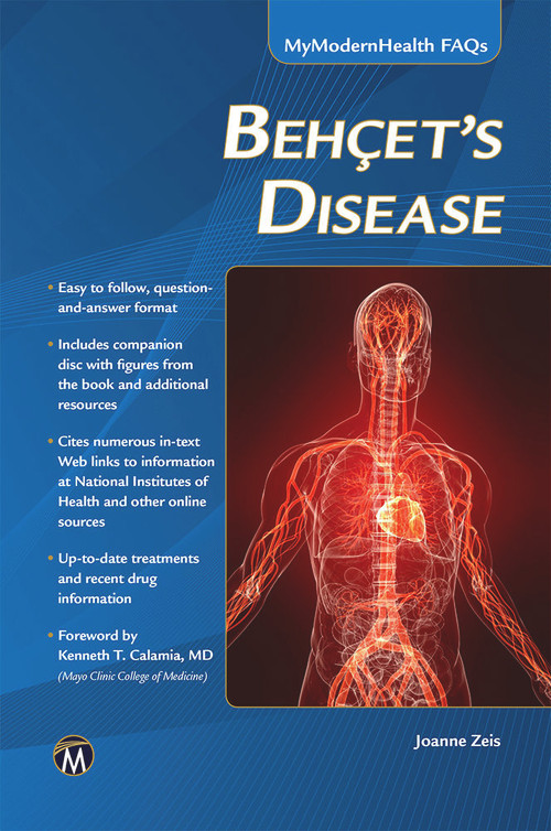 Behcet's Disease by Joanne Zeis, 9781938549403
