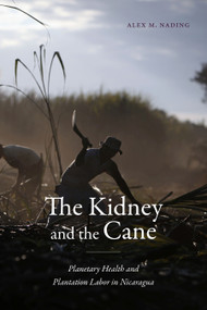 The Kidney and the Cane (Planetary Health and Plantation Labor in Nicaragua) by Alex M. Nading, 9781478031871