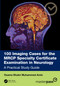 100 Imaging Cases for the MRCP Specialty Certificate Examination in Neurology (A Practical Study Guide) by Dr Osama Shukir Muhammed Amin, 9781041091516