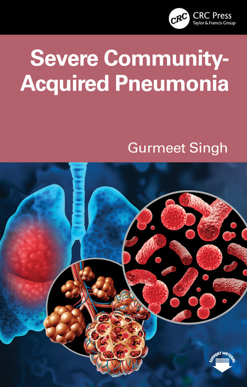 Severe Community-Acquired Pneumonia by Gurmeet Singh, 9781041047070