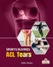 ACL Tears by India James, 9781039880795