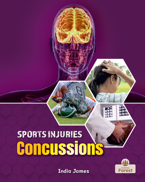 Concussions by India James, 9781039880801