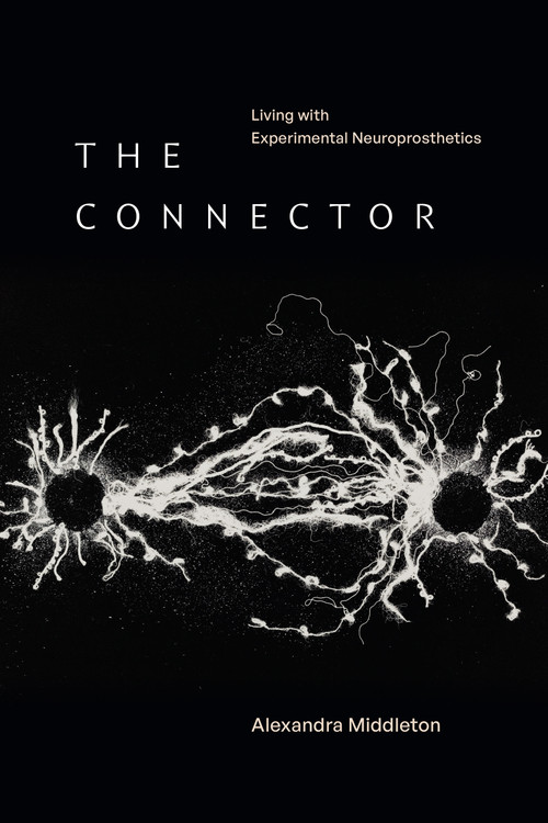 The Connector (Living with Experimental Neuroprosthetics) by Alexandra Middleton, 9781478038672