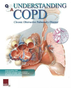 Understanding COPD Flip Chart by Scientific Publishing, 9781932922295