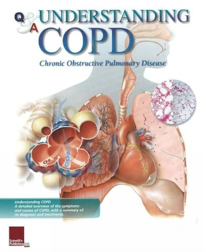 Understanding COPD Flip Chart by Scientific Publishing, 9781932922295