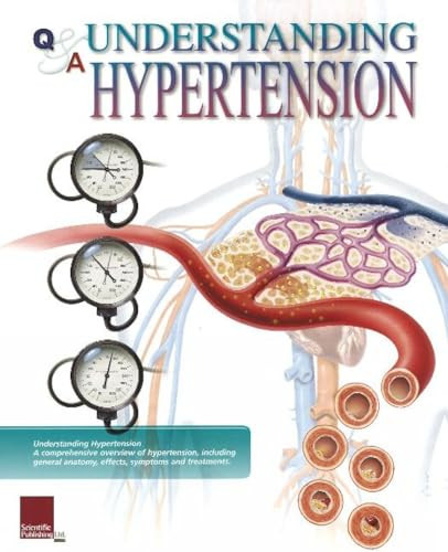 Understanding Hypertension Flip Chart by Scientific Publishing, 9781932922301