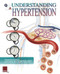 Understanding Hypertension Flip Chart by Scientific Publishing, 9781932922301